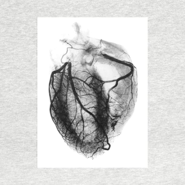 Coronary arteriogram of arteries of the heart 1904 (P216/0201) by SciencePhoto